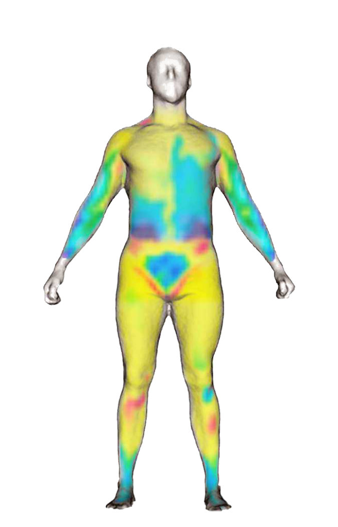 Infrared Thermography