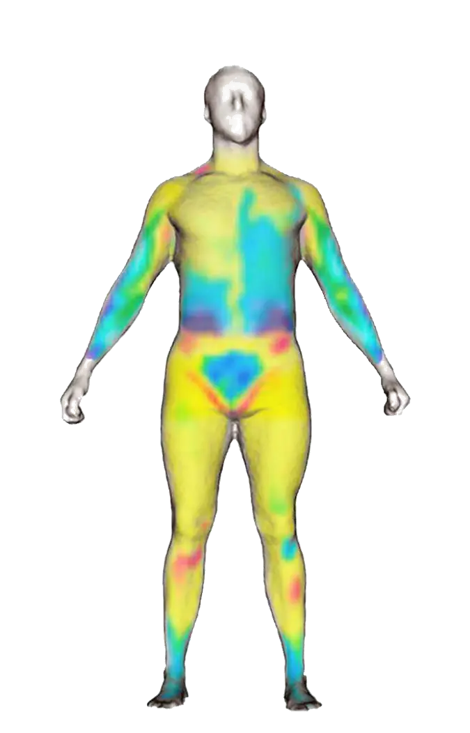 Infrared Thermography